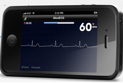 AliveCor monitor